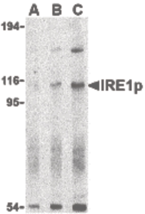 Western blot of IRE1p in A-20 cell lysate with IRE1p antibody at (A) 0.5, (B) 1 and (C) 2 ug/ml.