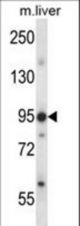 Mouse Ern1 Antibody western blot of mouse liver tissue lysates (35 ug/lane). The Ern1 antibody detected the Ern1 protein (arrow).