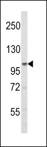 Western blot of ERN2 N-term in mouse stomach tissue lysates (35 ug/lane). ERN2 (arrow) was detected using the purified antibody.