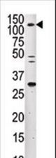 The anti-ERN2 antibody is used in Western blot to detect ERN2 in mouse liver tissue lysate