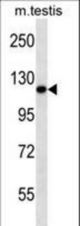 Mouse Ern2 Antibody western blot of mouse testis tissue lysates (35 ug/lane). The Ern2 antibody detected the Ern2 protein (arrow).