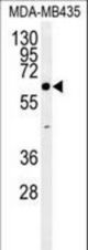 ERO1LB Antibody western blot of MDA-MB435 cell line lysates (35 ug/lane). The ERO1LB antibody detected the ERO1LB protein (arrow).