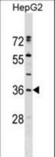 ERP27 Antibody western blot of HepG2 cell line lysates (35 ug/lane). The ERP27 antibody detected the ERP27 protein (arrow).