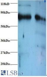 Western blot of Endoplasmic reticulum resident protein 29 antibody at 2 ug/ml. Lane 1: EC109whole cell lysate. Lane 2: 293T whole cell lysate. Secondary: Goat polyclonal to Rabbit IgG at 1:15000 dilution. Predicted band size: 29 kDa. Observed band size: 80 kDa.