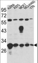 Western blot of ERP29 Antibody in A2058,A375,MCF7,NCI-H460,Y79 cell line lysates (35 ug/lane). ERP29 (arrow) was detected using the purified antibody.