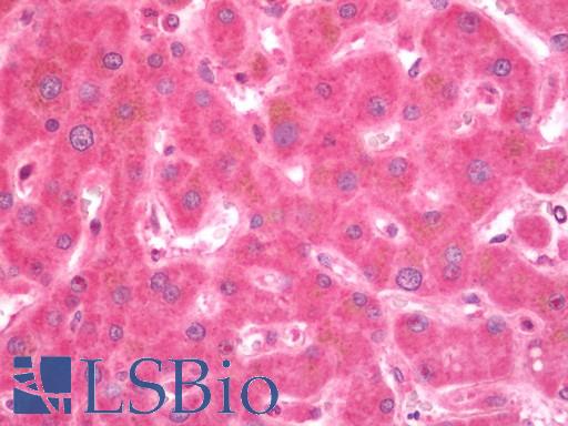 Human Liver: Formalin-Fixed, Paraffin-Embedded (FFPE)