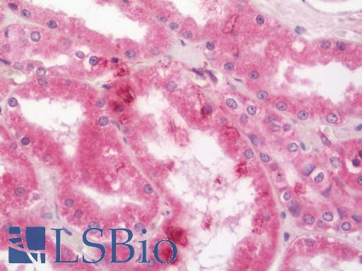 Human Kidney: Formalin-Fixed, Paraffin-Embedded (FFPE)