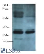 Western blot of Endoplasmic reticulum resident protein 29 antibody at 2 ug/ml. Lane 1: EC109 whole cell lysate. Lane 2: 293T whole cell lysate. Secondary: Goat polyclonal to Rabbit IgG at 1:15000 dilution. Predicted band size: 29 kDa. Observed band size: 29 kDa Additional bands at: 33 kDa, 55 kDa; We are unsure as to the identity of these extra bands.