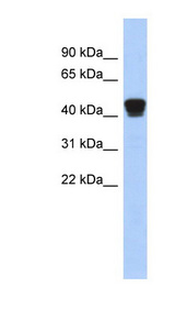 ERP44 / TXNDC4 antibody LS-C112239 Western blot of Placenta lysate.