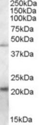 Antibody (0.2 ug/ml) staining of K562 lysate (35 ug protein in RIPA buffer). Primary incubation was 1 hour. Detected by chemiluminescence.