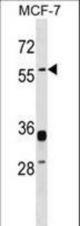 ERVWE1 Antibody western blot of MCF-7 cell line lysates (35 ug/lane). The ERVWE1 antibody detected the ERVWE1 protein (arrow).
