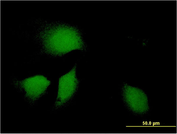 Immunofluorescence of monoclonal antibody to DNAJB9 on HeLa cell . [antibody concentration 10 ug/ml]