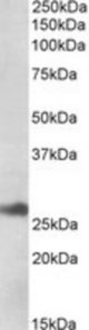 DNAJB9 antibody (1 ug/ml) staining of Human Liver lysate (35 ug protein/ml in RIPA buffer). Primary incubation was 1 hour. Detected by chemiluminescence.