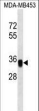 EpCAM Antibody western blot of MDA-MB453 cell line lysates (35 ug/lane). The EpCAM antibody detected the EpCAM protein (arrow).