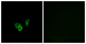 Immunofluorescence of A549 cells, using CNGA2 Antibody. The picture on the right is treated with the synthesized peptide.
