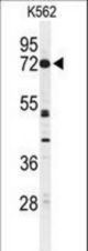 Western blot of CNGA2 Antibody in K562 cell line lysates (35 ug/lane). CNGA2 (arrow) was detected using the purified antibody.