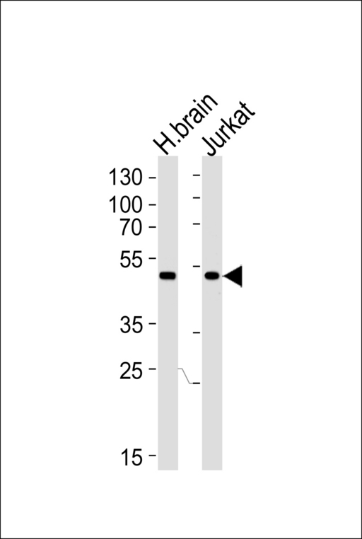 Western blot of lysates from human brain tissue lysate and Jurkat cell line (from left to right), using CHN1 Antibody. Antibody was diluted at 1:1000 at each lane. A goat anti-rabbit IgG H&L (HRP) at 1:5000 dilution was used as the secondary antibody. Lysates at 35ug per lane.