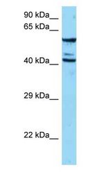 ESAM antibody Western Blot of Jurkat.