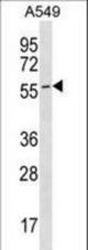 ESAM Antibody western blot of A549 cell line lysates (35 ug/lane). The ESAM antibody detected the ESAM protein (arrow).