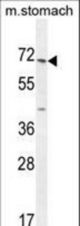 ESCO2 Antibody western blot of mouse stomach tissue lysates (35 ug/lane). The ESCO2 antibody detected the ESCO2 protein (arrow).