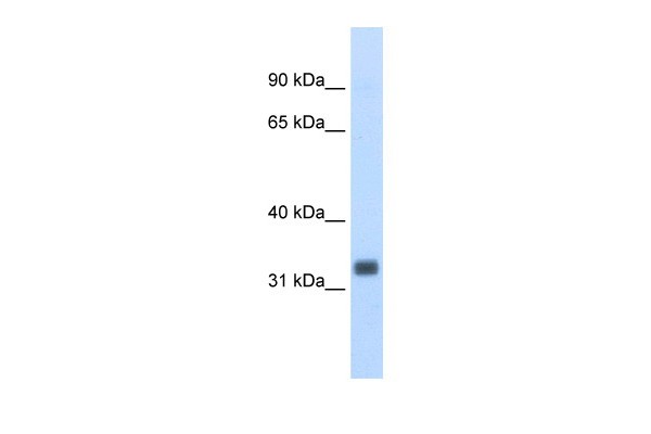Western blot analysis of mouse prostate lysate using Anti-ESE3 / EHF Antibody (aa71-120).