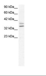 Jurkat Cell Lysate