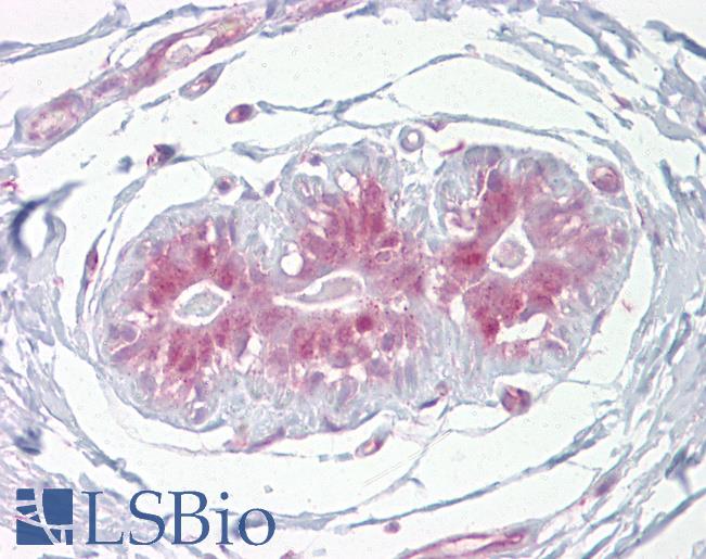 Anti-EHF antibody IHC of human breast. Immunohistochemistry of formalin-fixed, paraffin-embedded tissue after heat-induced antigen retrieval. Antibody LS-B6804 concentration 5 ug/ml.