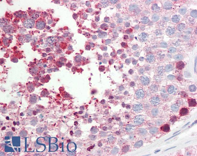 Anti-CNGA2 antibody IHC staining of human testis. Immunohistochemistry of formalin-fixed, paraffin-embedded tissue after heat-induced antigen retrieval. Antibody LS-B9623 dilution 1:100.