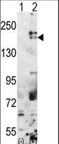 Western blot of SETDB1(arrow) using rabbit polyclonal SETDB1 Antibody. 293 cell lysates (2 ug/lane) either nontransfected (Lane 1) or transiently transfected with the SETDB1 gene (Lane 2) (Origene Technologies).