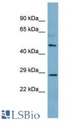 CNGA4 antibody Western Blot of Fetal Thymus. Antibody dilution: 1 ug/ml.