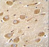 CNGA4 Antibody immunohistochemistry of formalin-fixed and paraffin-embedded human brain tissue followed by peroxidase-conjugated secondary antibody and DAB staining.
