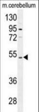 CNGA4 Antibody western blot of mouse cerebellum tissue lysates (35 ug/lane). The CNGA4 antibody detected the CNGA4 protein (arrow).