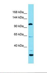 Western blot of Human NCI-H226. ESPNL antibody dilution 1.0 ug/ml.