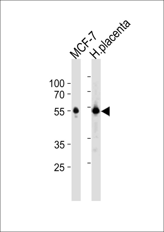 ESR2 Antibody western blot of MCF-7 cell line and human placenta tissue lysates (35 ug/lane). The ESR2 antibody detected the ESR2 protein (arrow).