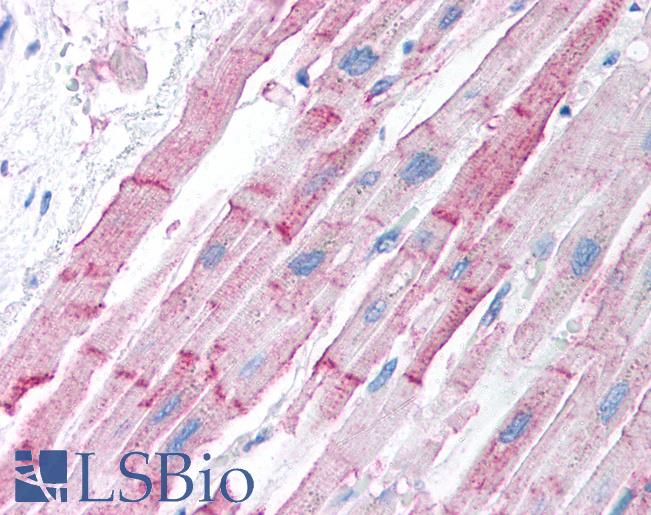 Anti-ER-Beta antibody IHC of human heart. Immunohistochemistry of formalin-fixed, paraffin-embedded tissue after heat-induced antigen retrieval. Antibody LS-B945 concentration 5 ug/ml.
