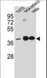 ESR2 Antibody western blot of T47D?MDA-MB453?HeLa cell line lysates (35 ug/lane). The ESR2 antibody detected the ESR2 protein (arrow).