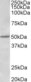 ESR2 antibody (1 ug/ml) staining of Human Placenta lysate (35 ug protein in RIPA buffer). Primary incubation was 1 hour. Detected by chemiluminescence.
