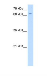 HCT116 cell lysate. Antibody concentration: 5.0 ug/ml. Gel concentration: 12%.