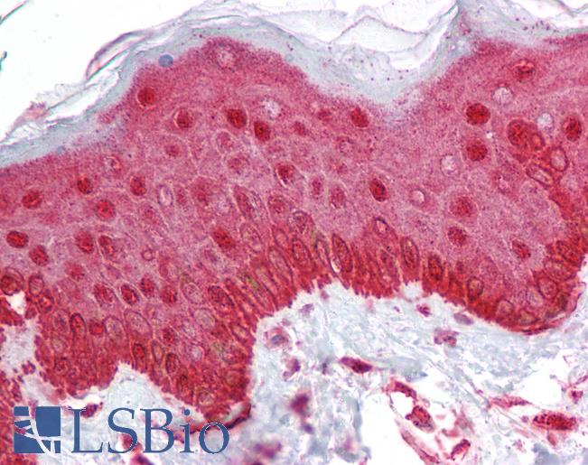 Anti-ESRP1 / RBM35A antibody IHC of human skin. Immunohistochemistry of formalin-fixed, paraffin-embedded tissue after heat-induced antigen retrieval. Antibody LS-B7036 concentration 5 ug/ml.