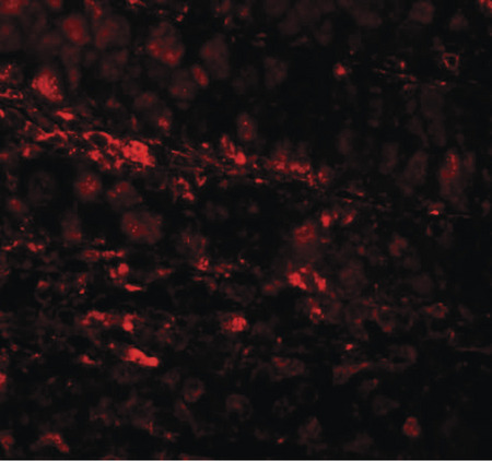 Immunofluorescence of RBM35A in human colon tissue cells with RBM35A antibody at 20 ug/ml.