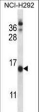 CNIH Antibody western blot of NCI-H292 cell line lysates (35 ug/lane). The CNIH antibody detected the CNIH protein (arrow).