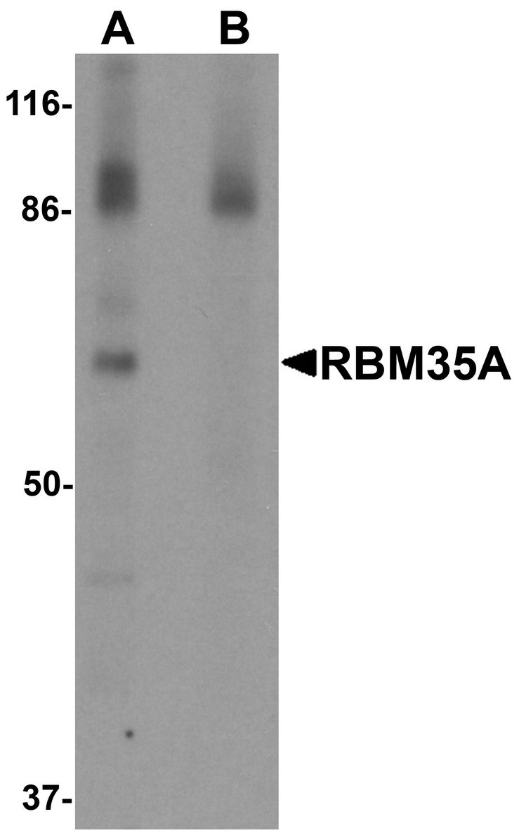 Western blot analysis of RBM35A in rat colon tissue lysate with RBM35A antibody at 0.5 ug/ml in (A) the absence and (B) the presence of blocking peptide.
