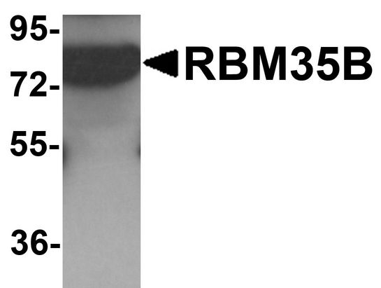 Western blot analysis of RBM35B in human lung tissue lysate with RBM35B antibody at 1 ug/ml.