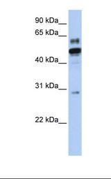 Transfected 293T cell lysate. Antibody concentration: 1.0 ug/ml. Gel concentration: 12%.