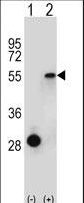 Western blot of ESRRA (arrow) using rabbit polyclonal ESRRA Antibody. 293 cell lysates (2 ug/lane) either nontransfected (Lane 1) or transiently transfected (Lane 2) with the ESRRA gene.
