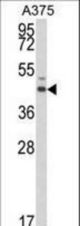 Western blot of ESRRA Antibody in A375 cell line lysates (35 ug/lane). ESRRA (arrow) was detected using the purified antibody.
