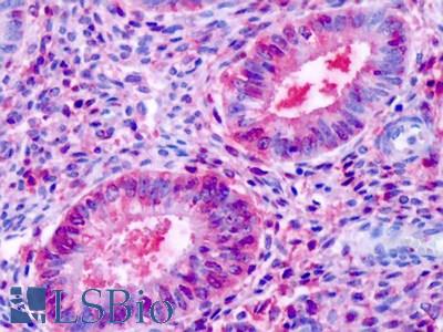 Anti-ESRRB / ERR-Beta antibody IHC of human uterus, endometrial glands. Immunohistochemistry of formalin-fixed, paraffin-embedded tissue after heat-induced antigen retrieval. Antibody LS-A7129 dilution 1 ug/ml.