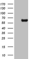 HEK293T cells were transfected with the pCMV6-ENTRY control (Left lane) or pCMV6-ENTRY ESRRB (Right lane) cDNA for 48 hrs and lysed. Equivalent amounts of cell lysates (5 ug per lane) were separated by SDS-PAGE and immunoblotted with anti-ESRRB.