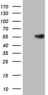 HEK293T cells were transfected with the pCMV6-ENTRY control (Left lane) or pCMV6-ENTRY ESRRB (Right lane) cDNA for 48 hrs and lysed. Equivalent amounts of cell lysates (5 ug per lane) were separated by SDS-PAGE and immunoblotted with anti-ESRRB.