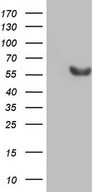 HEK293T cells were transfected with the pCMV6-ENTRY control (Left lane) or pCMV6-ENTRY ESRRB (Right lane) cDNA for 48 hrs and lysed. Equivalent amounts of cell lysates (5 ug per lane) were separated by SDS-PAGE and immunoblotted with anti-ESRRB.